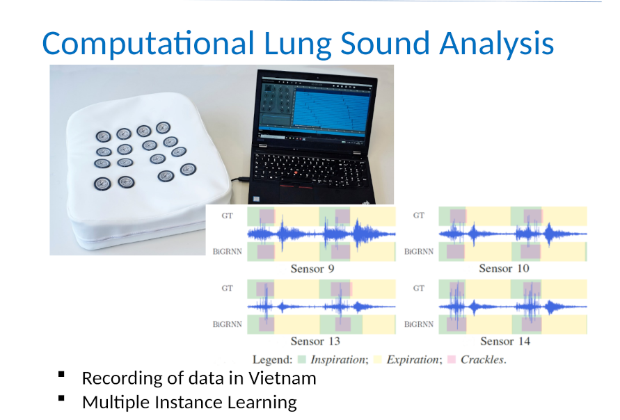 Computational Lung Sound Analysis